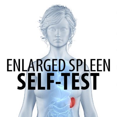 dr oz enlarged spleen  check    spleen  video