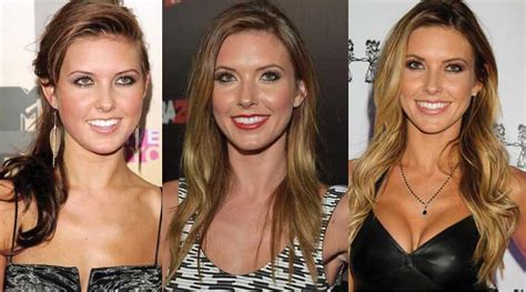 Audrina Patridge Plastic Surgery Before And After Pictures