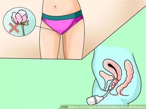 6 ways to cure vaginal infections without using medications vaginal
