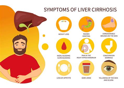 chronic liver disease   symptoms alcohol rehab guide  xxx