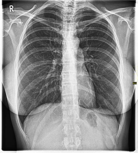 roentgen radiologie praxis im duererhof