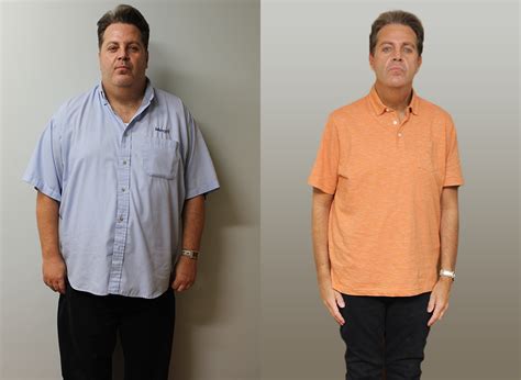 Frank S Weight Loss Transformation St Louis Bariatrics