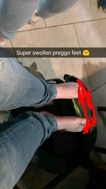 Swollen Preggo Feet Glow Community