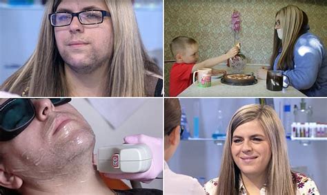 russian woman grew an unwanted beard after giving birth