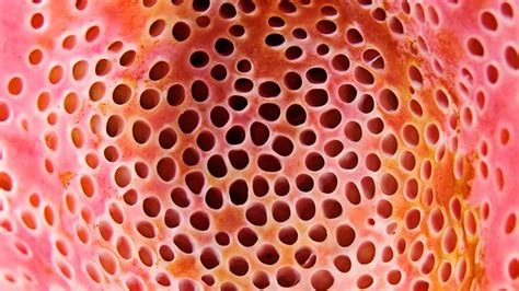What Is Trypophobia And Is There A Cure Everyday Health