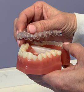 vivera clear retainers  invisalign brookline dental
