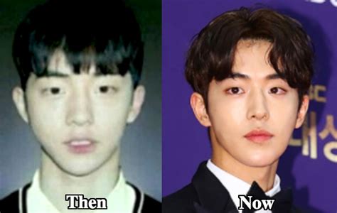 Nam Joo Hyuk Plastic Surgery Before And After Photos