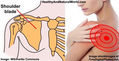 shoulder blade pain    home treatments