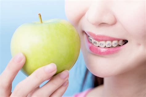 จัดฟันใช้เวลานานเท่าไหร่ คลินิกทันตกรรมโลตัสอ่อนนุช จัดฟัน ฟอกสีฟัน