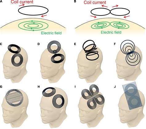 frontiers figure  coils  magnetic stimulation  focal