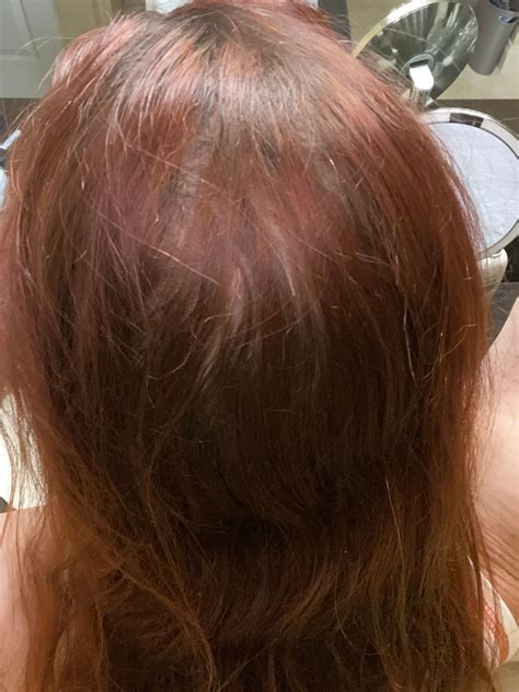 olaplex 3 and hair loss beauty insider community