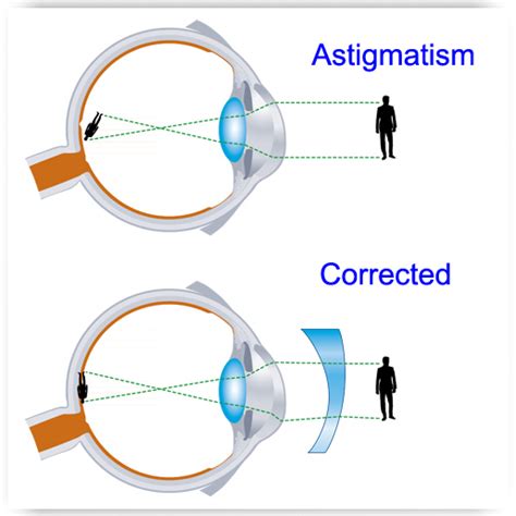 astigmatism eye exams optometrists oxford  henderson nc