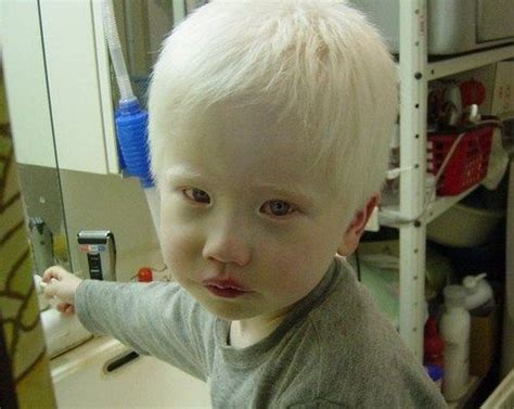 104 best albino beauties images on pinterest albinism