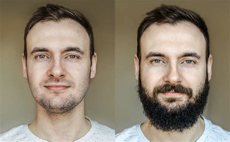 how to fix a patchy beard bossman brands