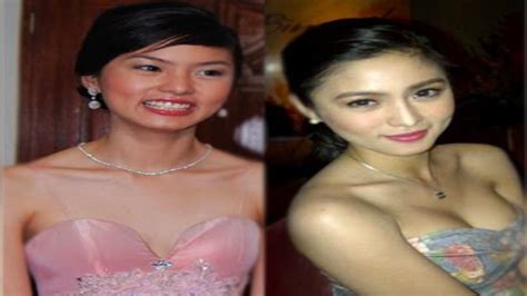 pinoy top list top pinay celebrities who underwent plastic surgery part 1