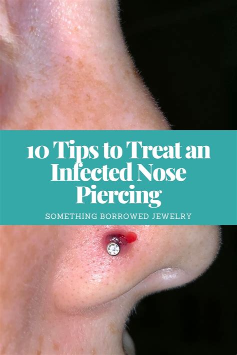 10 tips to treat an infected nose piercing