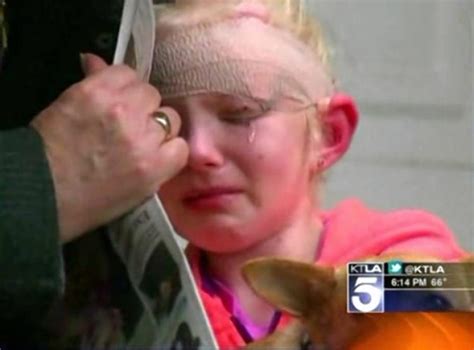 Chihuahua Saves Girl From Pit Bull Mauling Ny Daily News