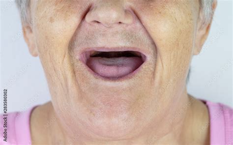 toothless mouth  elderly woman   teeth  granny