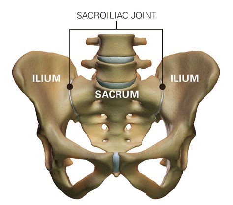 joint pain sacroiliac joint pain spine doctor