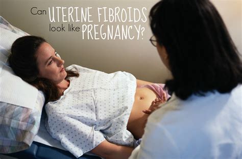 Can Uterine Fibroids Look Like Pregnancy Ask4ufe