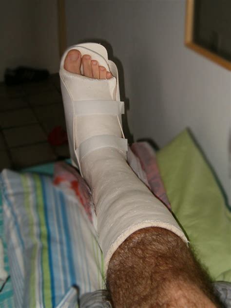 Sprained Ankle An Athlete S Life Felipe Quérette Flickr