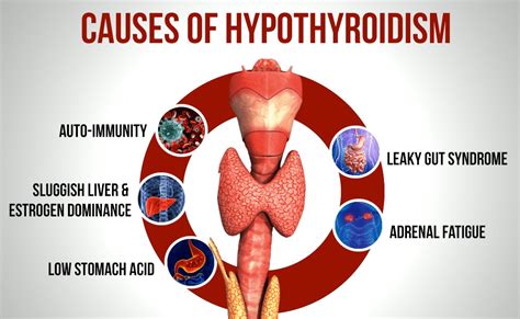 Understanding Hypothyroidism — The Holistic Health Approach