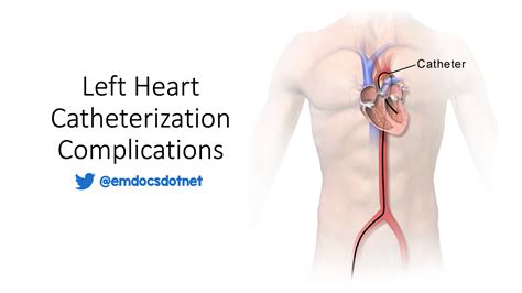emergency medicine educationleft heart catheterization