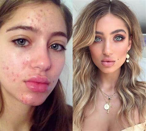 Belle Lucia Instagram Model Shares Before And After Snaps It Goes