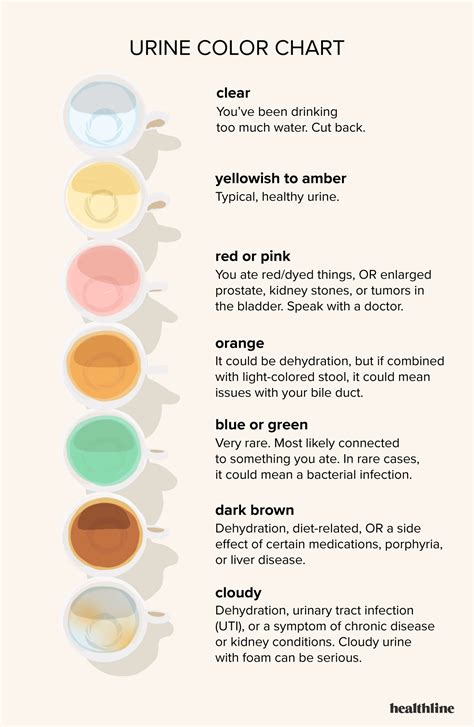 urine color chart whats normal      doctor nurse study