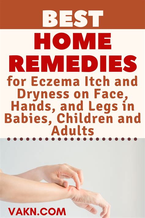 Best Home Remedies For Eczema Itch And Dryness On Face