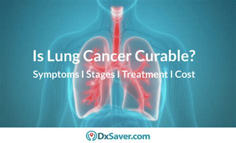 Lung Cancer Stages Know More About Early Symptoms Types And Causes