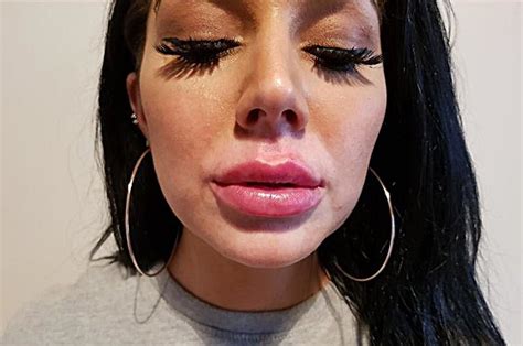 lip fillers mum grace teal looked like she d done 10 rounds with mike