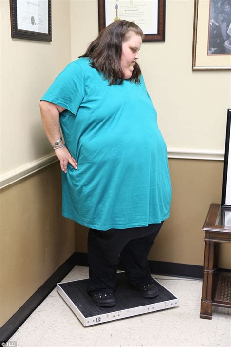 My 600lbs Susan Farmer Who Weighed 43st Loses Almost Half Her Body
