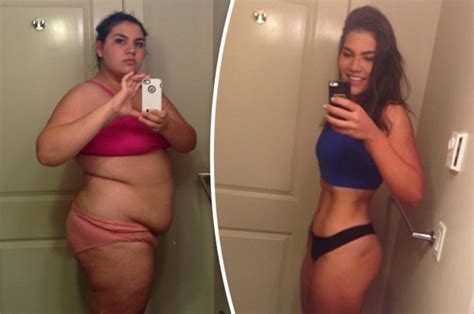 morbidly obese woman halves body weight in 12 months