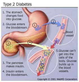 diabetes deactivated review  erk  blame   diabetic nightmare newspaper cat