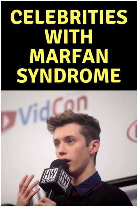 12 Famous People With Klinefelter Syndrome Or Marfan Syndrome – Artofit