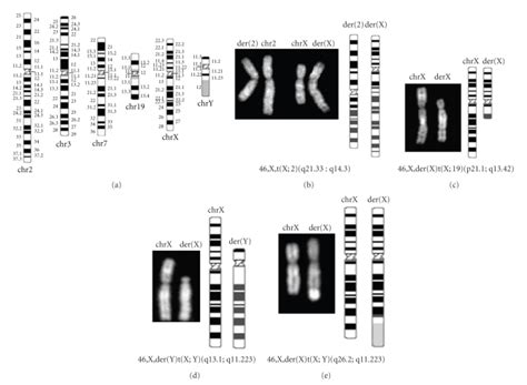 Conventional Cytogenetic Analysis A Ideograms Of The Normal