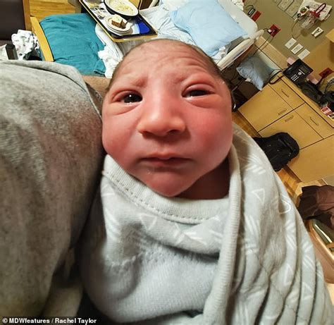 mother  baby boy born   tiny head reveals doctors thought