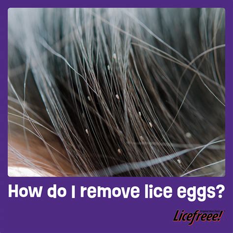 remove lice eggs licefreee