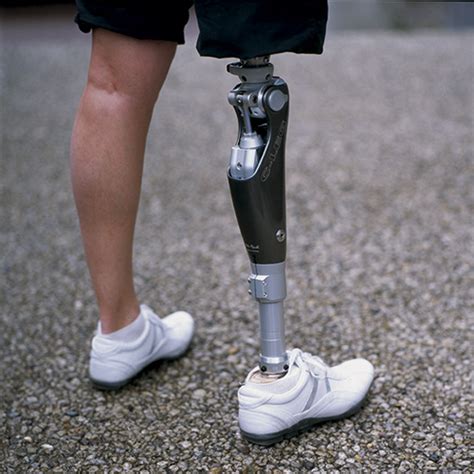 prosthetics biodesign prosthetics orthotics