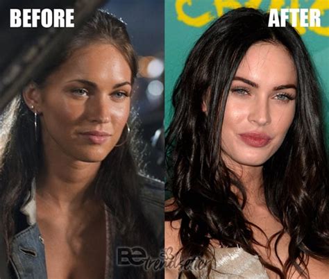 Megan Fox Plastic Surgery Before And After Revealed 2019