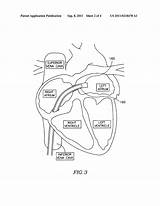 Circulatory sketch template