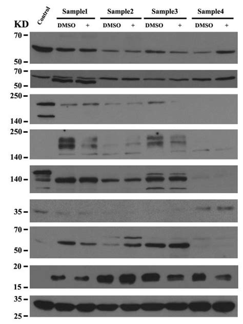 western blot analysis   celplor llc  molecular biology cro company