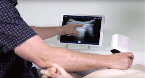 Application Of Ultrasound Scanner Amis Medical