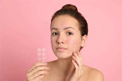 acne patches    essence   product     work