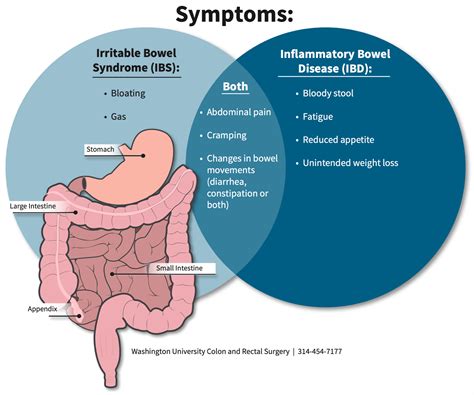 inflammatory bowel disease  irritable bowel syndrome department