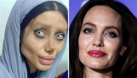 Woman Looks Like Corpse Bride After Surgery To Look Like