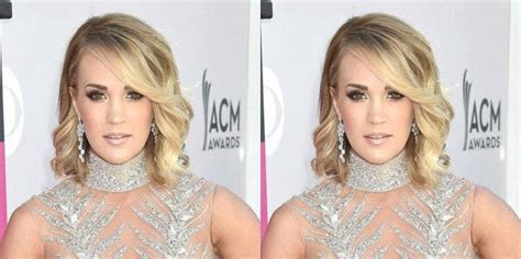 New Photos Of Carrie Underwood S Face After Fall Stairs Surgery