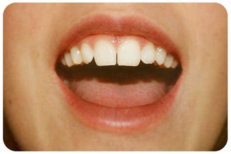 gap tooth gap teeth photographer teeth