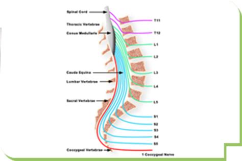 Cauda Equina Syndrome Spine Surgery स्पाइन सर्जरी सर्विस